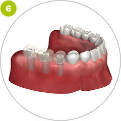 Step 6