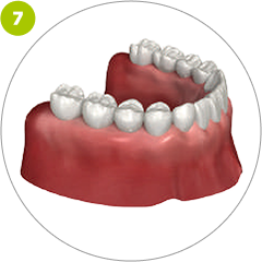 Step 7