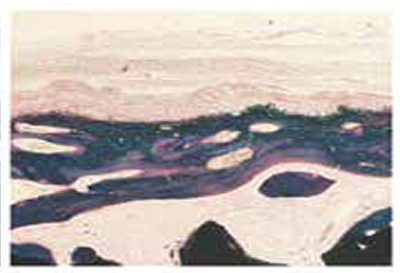 Micropore