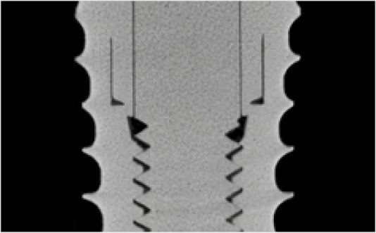 Joint stability