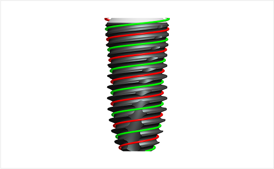 Joint stability